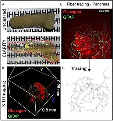 Pancreas Optical Clearing and 3-D Microscopy in Health and Diabetes